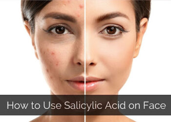 What Does Salicylic Acid Do for Skin?