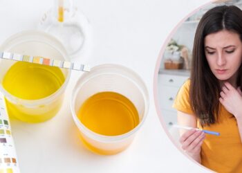 Having Protein in Your Urine During Pregnancy